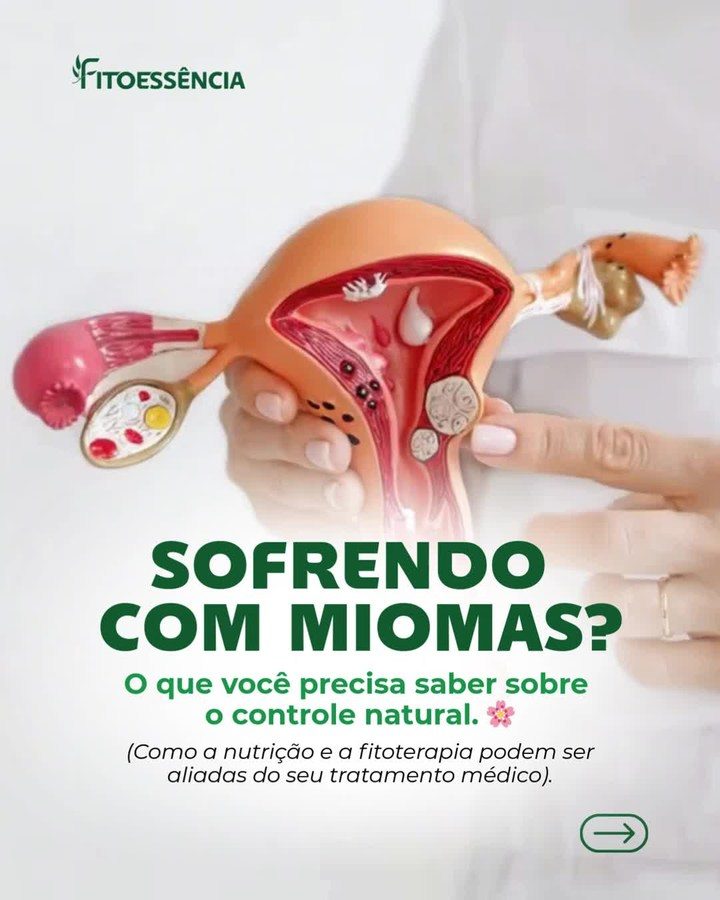 FitoEssência ad. Angle: Suffering from fibroids? What to know about natural control